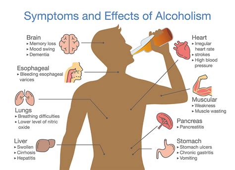 under the influence of alcohol word hike|Alcohol Abuse and Alcoholism: Signs, Symptoms, and Diagnosis.